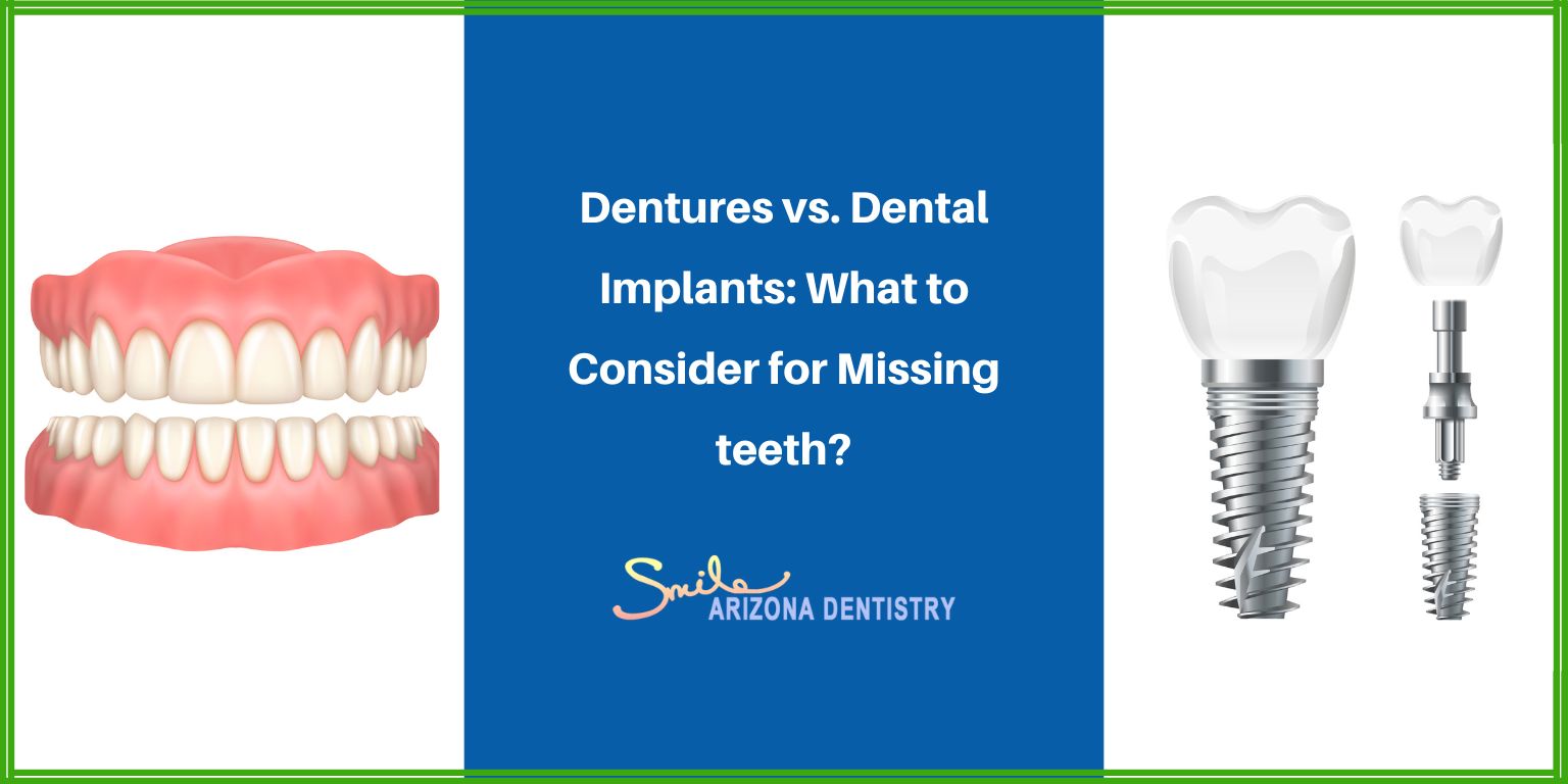 Dentures vs. Dental Implants