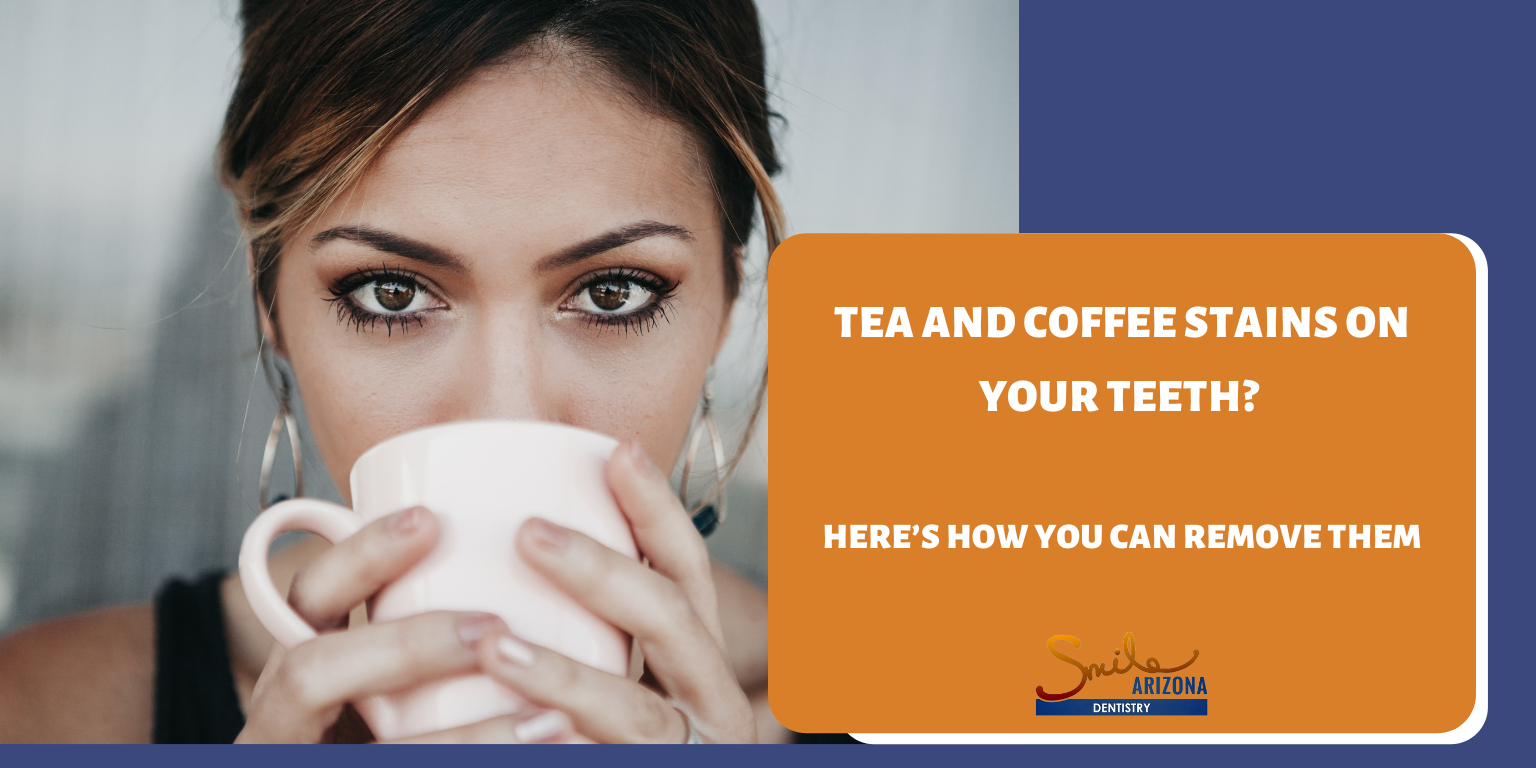 Tea and Coffee Stains on Your Teeth? Here’s How You Can Remove Them