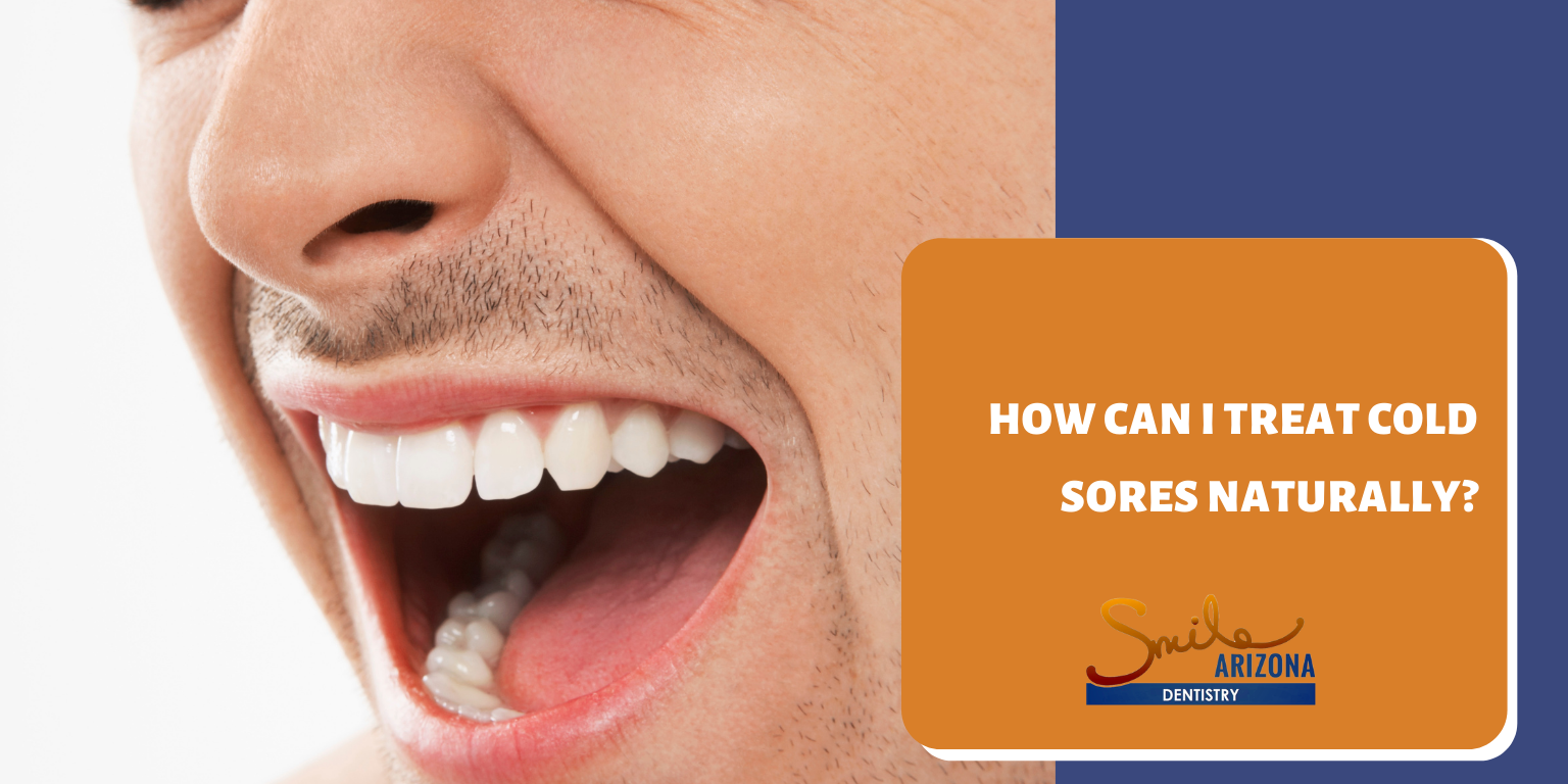 How Can I Treat Cold Sores Naturally?