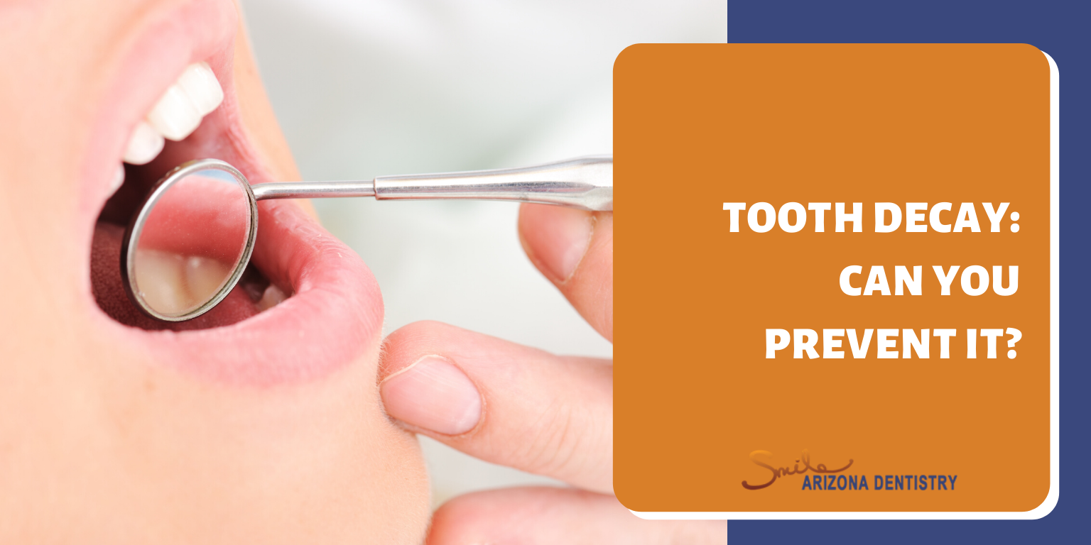 Tooth Decay: Can You Prevent It?