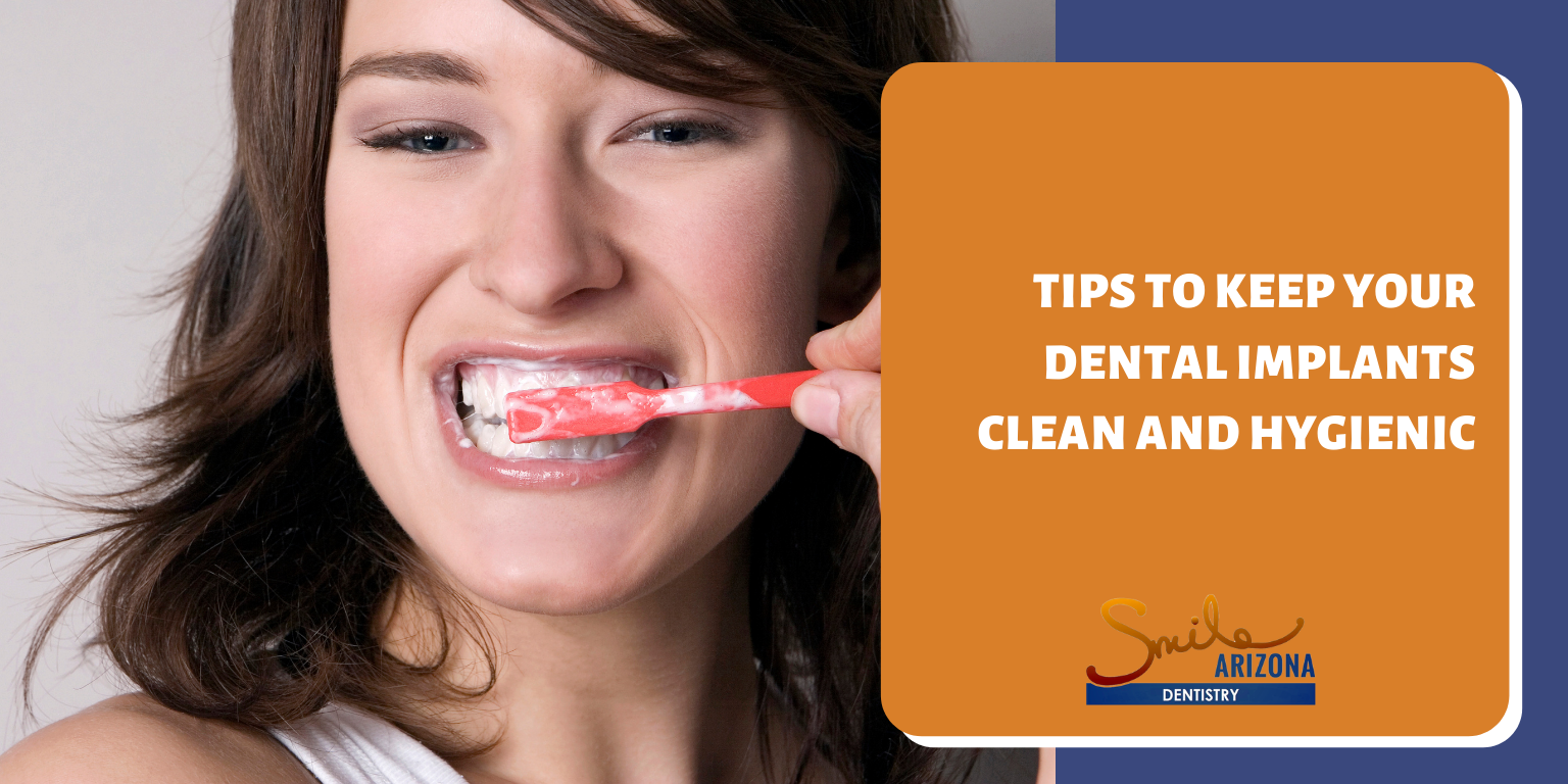 Tips to Keep Your Dental Implants Clean and Hygienic