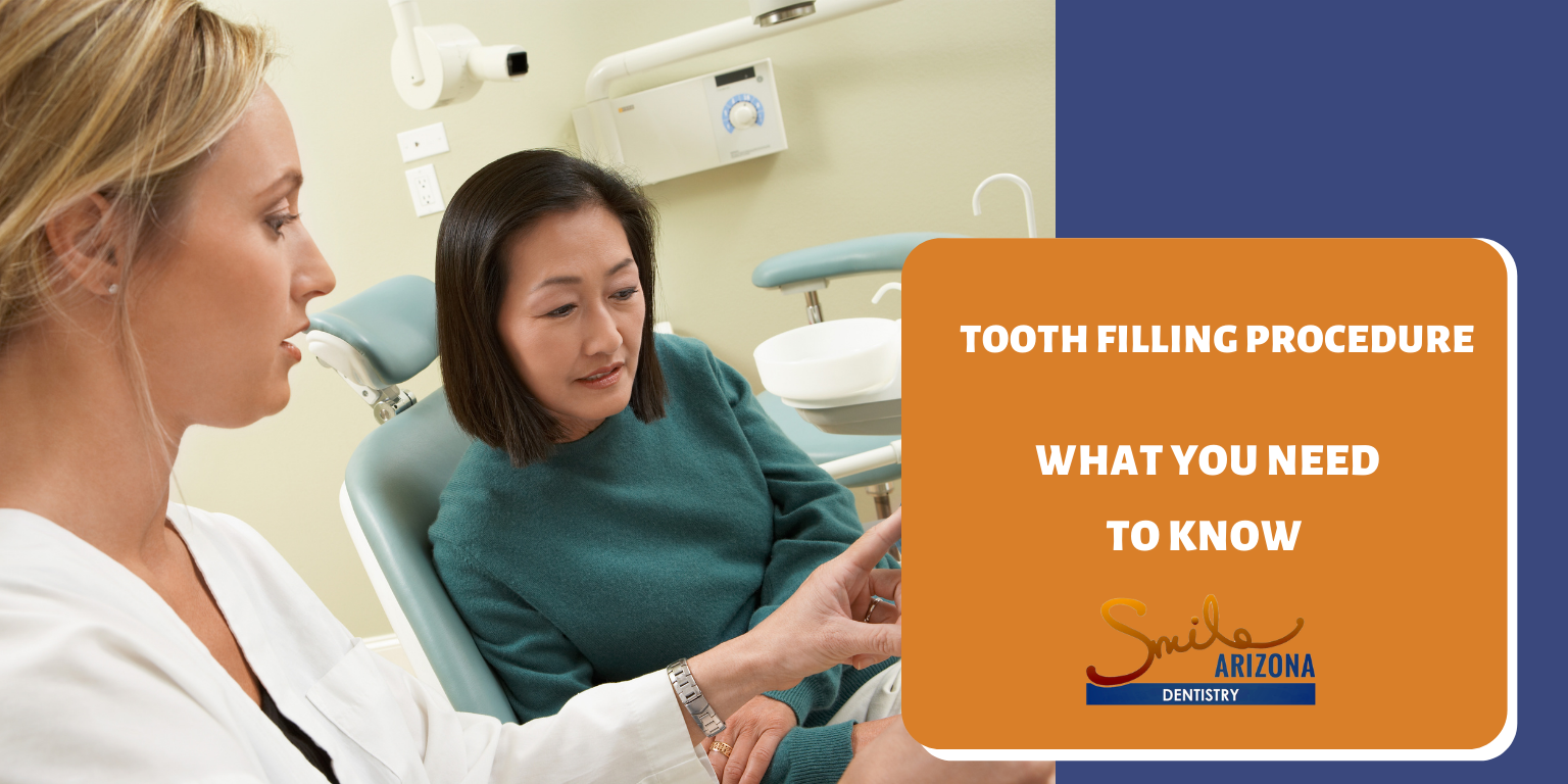 Tooth Filling Procedure: What You Need to Know
