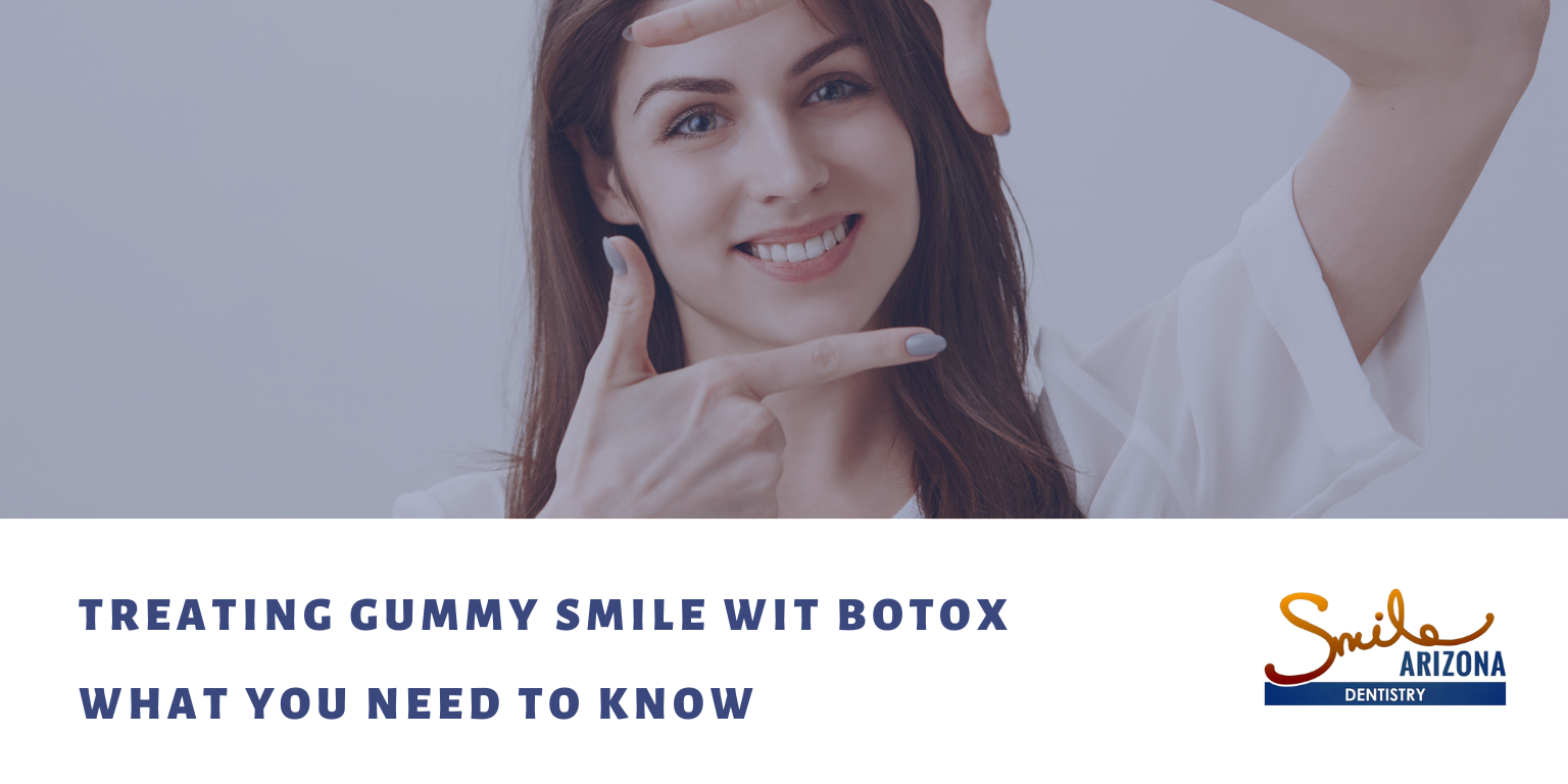 Treating Gummy Smile with Botox: What You Need to Know