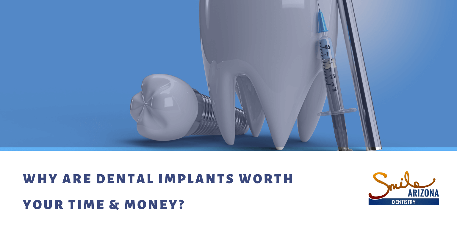 Why Are Dental Implants Worth Your Time & Money?