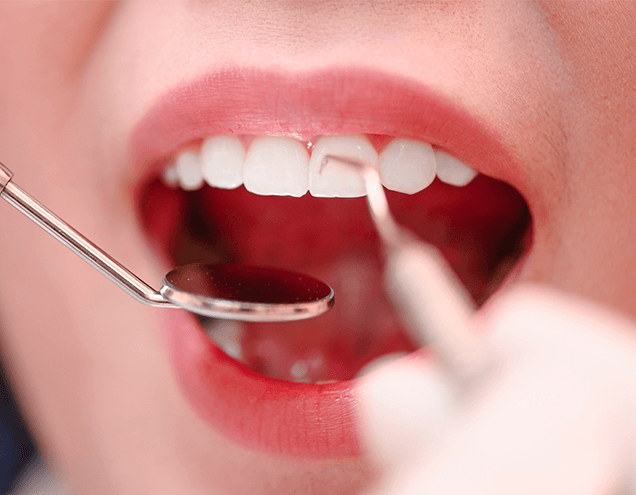 When Is a Filling Prescribed for Your Tooth?