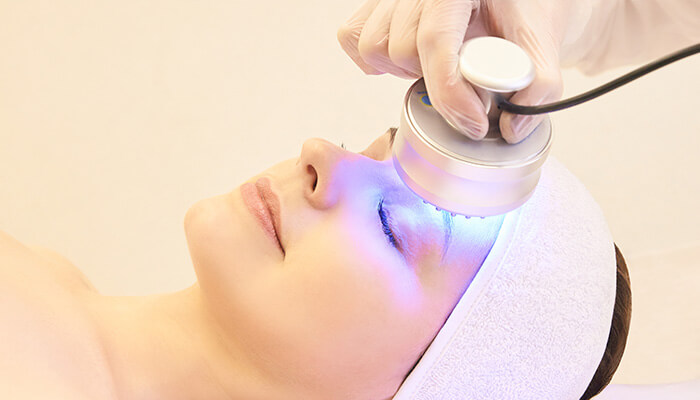 Why is the RF skin resurfacing method popular?